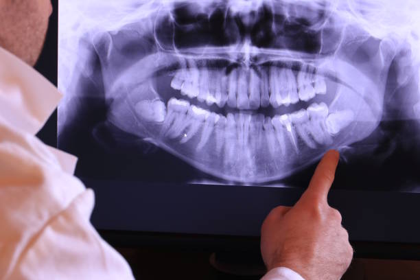Best Broken or Chipped Tooth Repair in Lakewood, WA